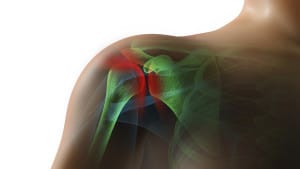 sudden should pain, integrated orthopedics
