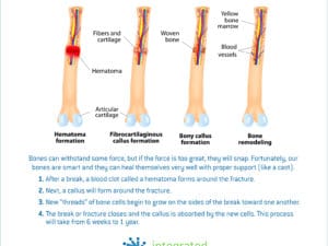 How a broken bone heals