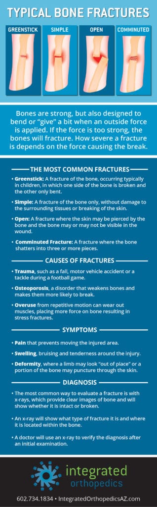 nov_infographic_fractures_r2