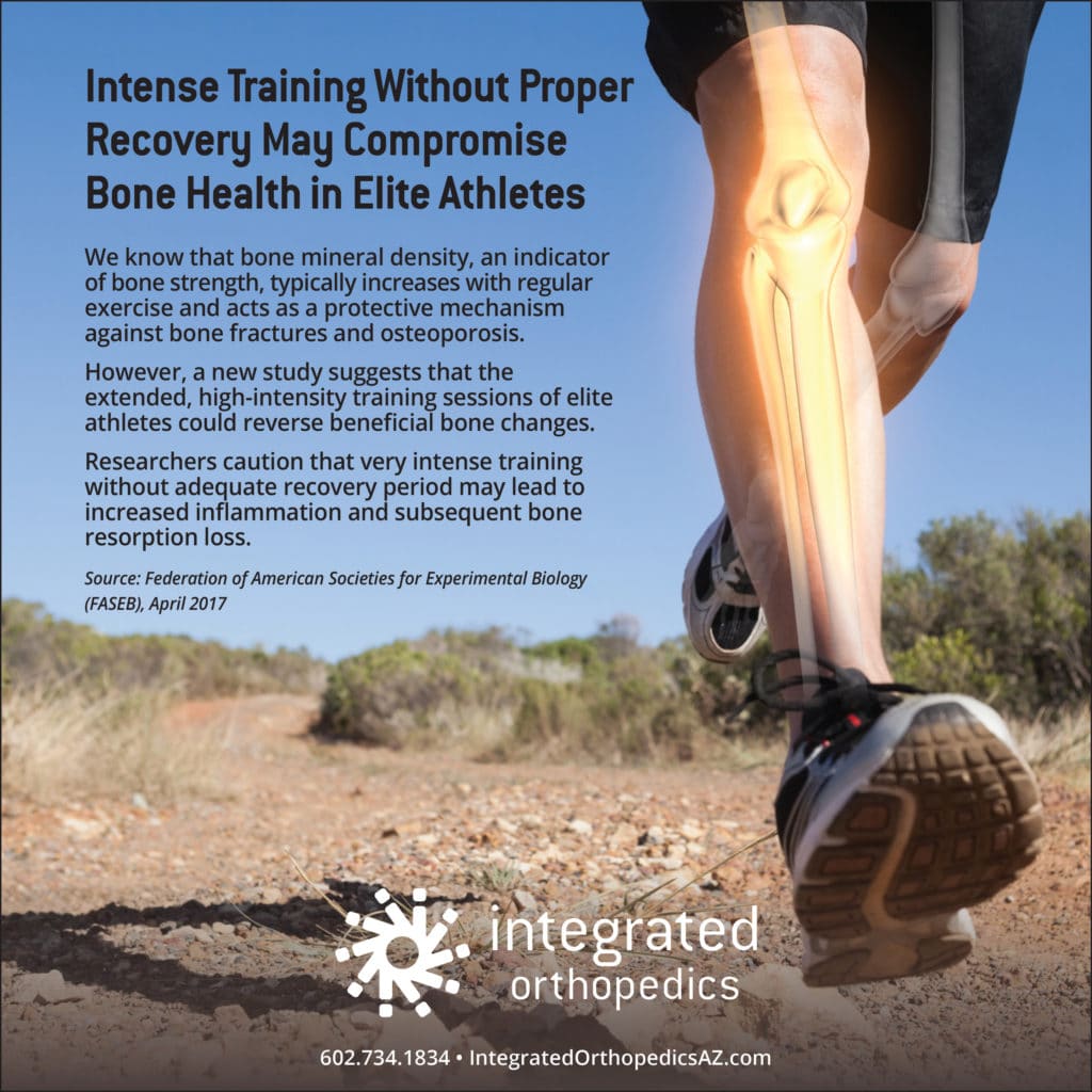 bone health, bone injuries, fractures, broken bone, broken bones, orthopedics, sports medicine