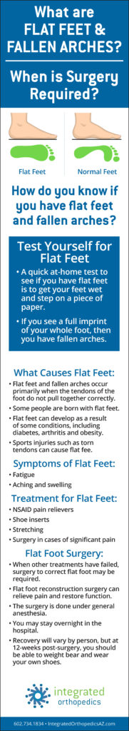 flat feet, fallen arches, foot doctors, foot surgeons