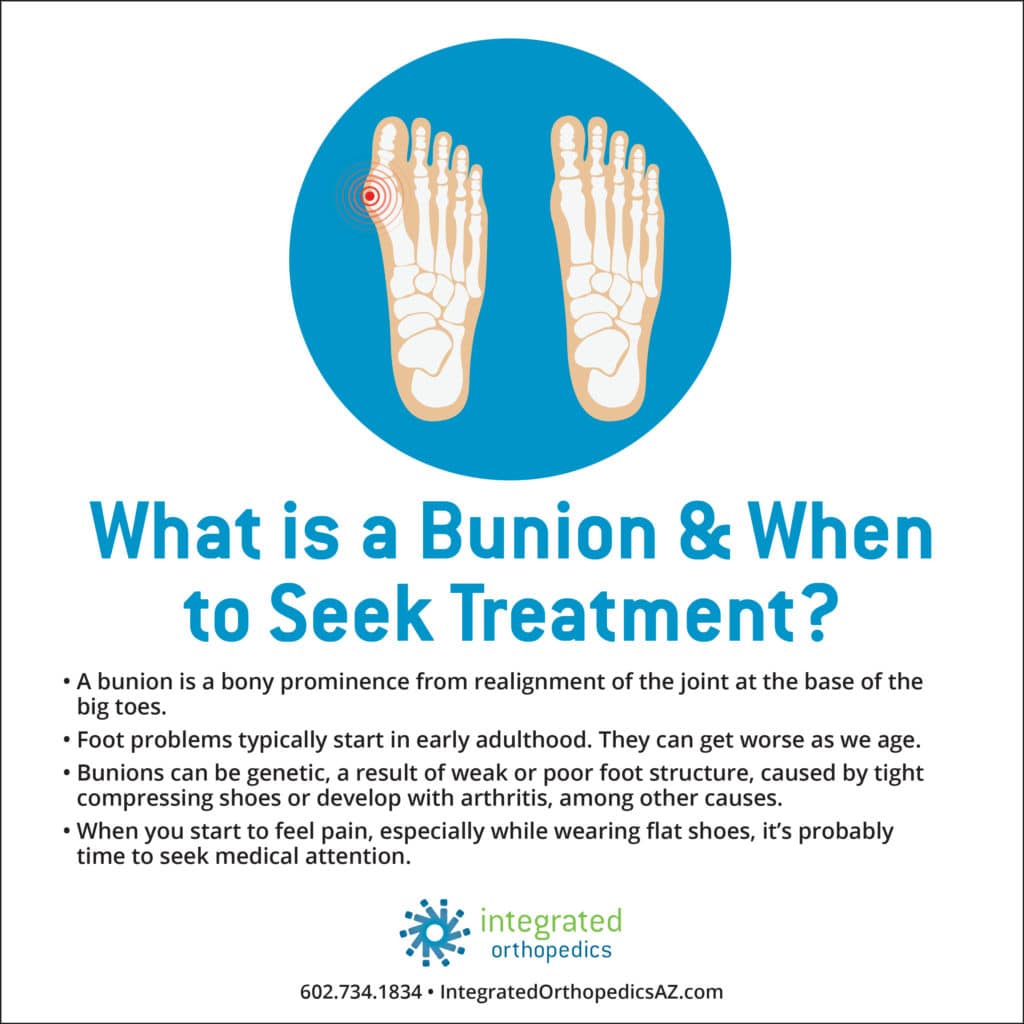bunion, foot surgery, foot problems, foot pain, bunions