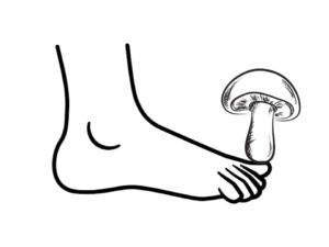 toenail fungus, toenail fungus treatement