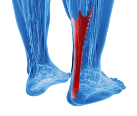 All You Need to Know About Achilles Tendonitis