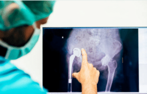 orthopedic surgery