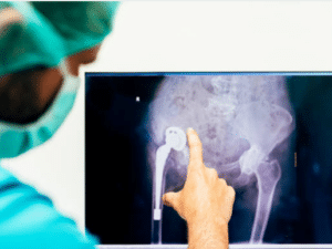 When Should You Consider Orthopedic Surgery?
